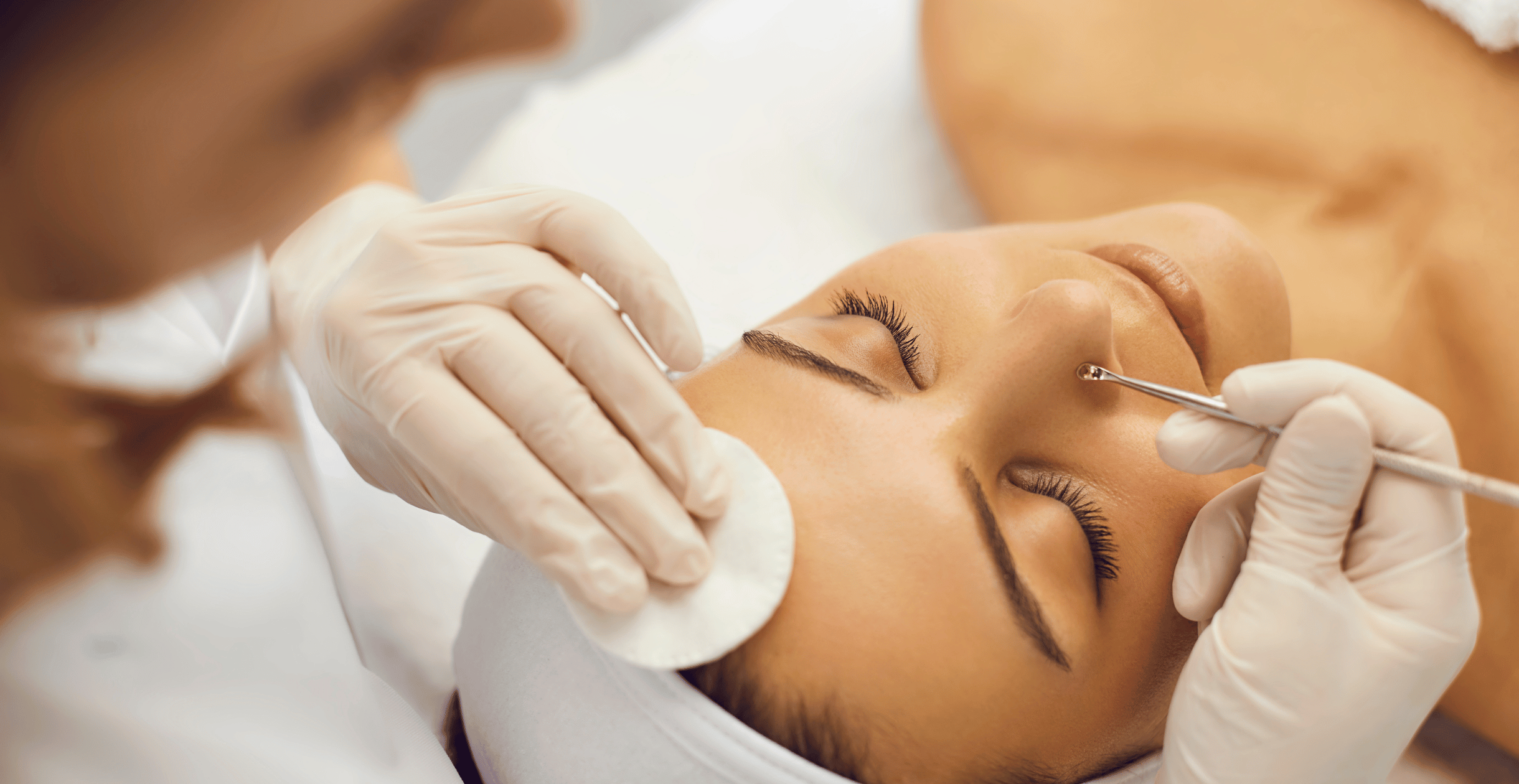 Unveiling the Truth Behind Whiteheads: Understanding the Problem