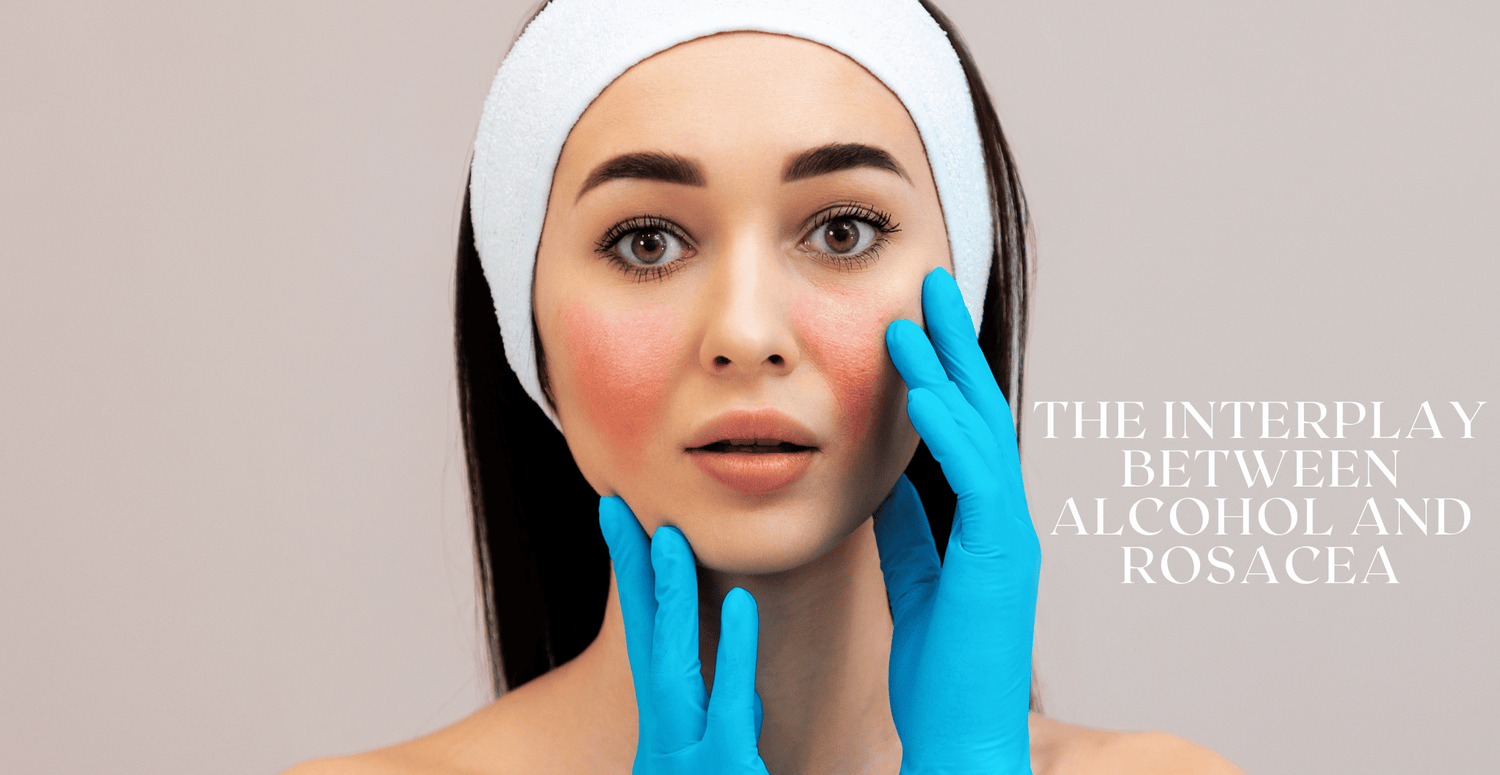 the Interplay Between Alcohol and Rosacea