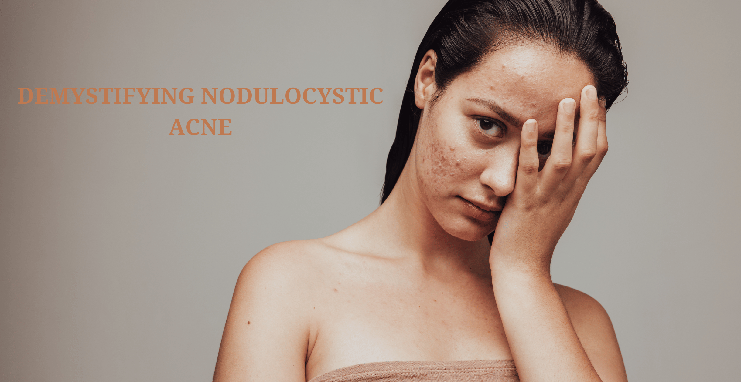 Demystifying Nodulocystic Acne: Understanding and Managing the Condition