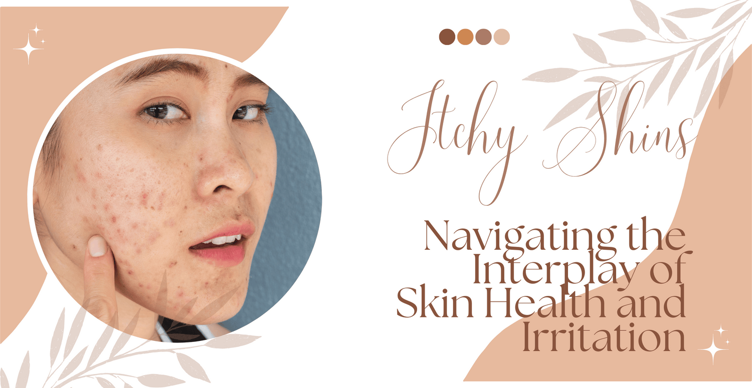 Itchy Shins: Navigating the Interplay of Skin Health and Irritation