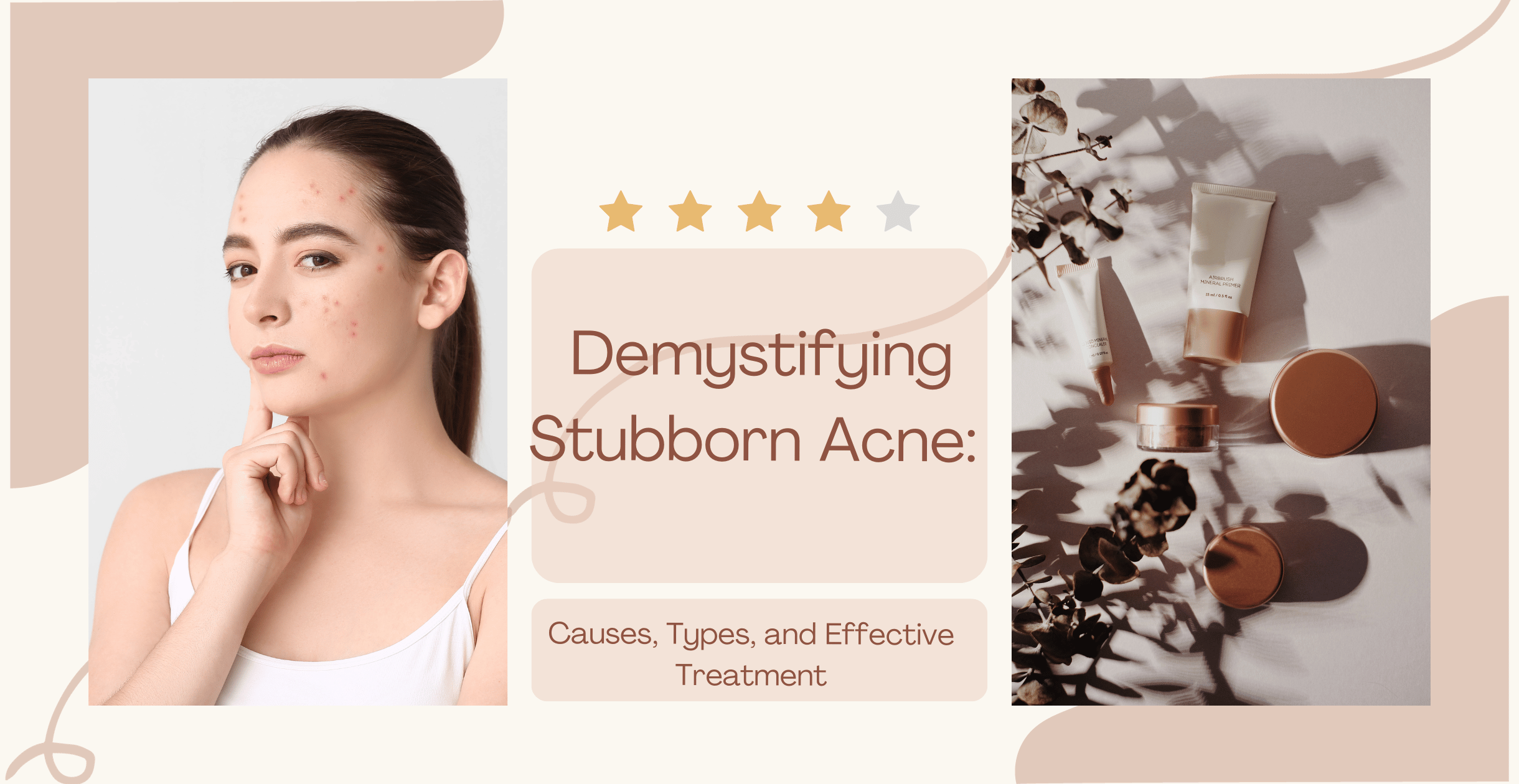 Demystifying Stubborn Acne: Causes, Types, and Effective Treatment
