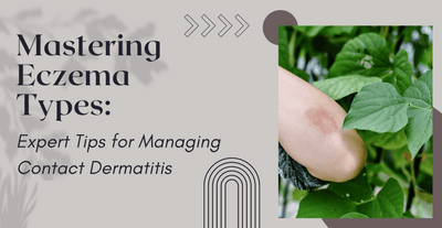Mastering Eczema Types: Expert Tips for Managing Contact Dermatitis
