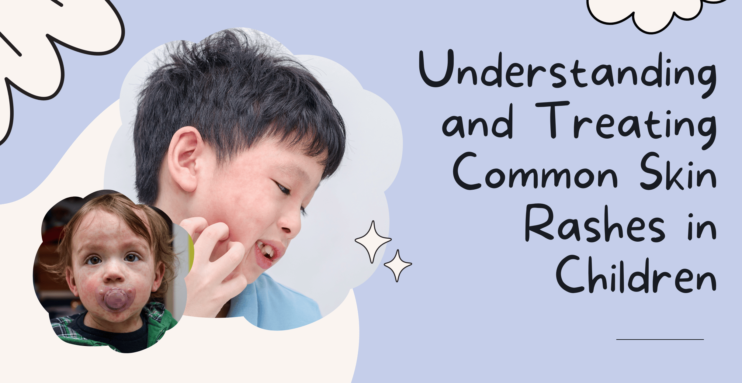 Understanding and Treating Common Skin Rashes in Children
