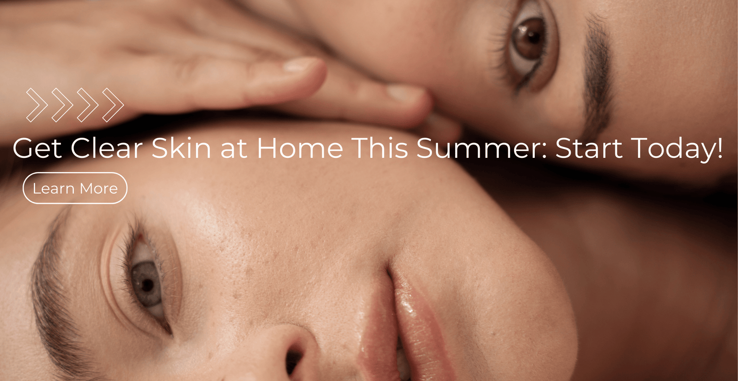 Get Clear Skin at Home This Summer: Start Today!