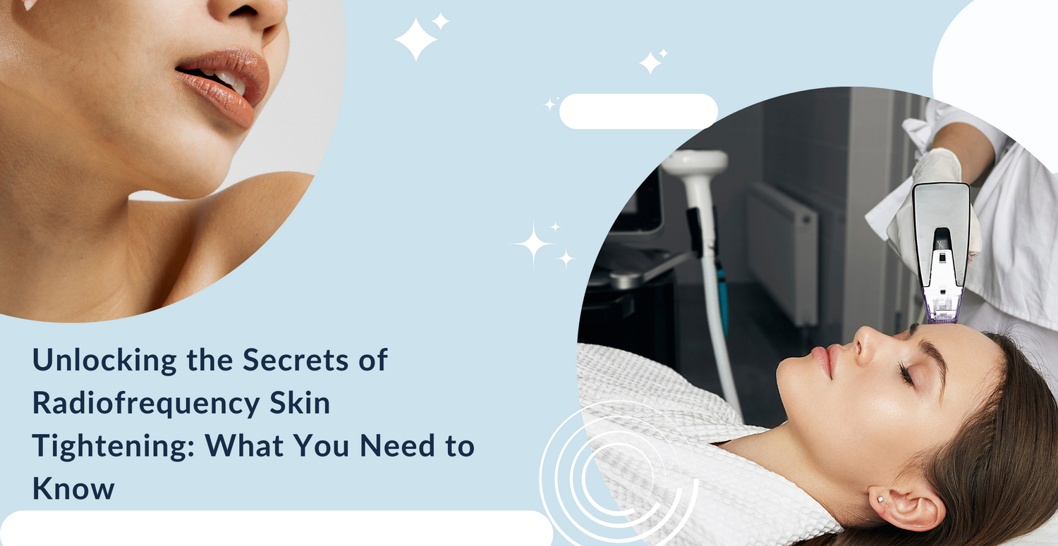 Unlocking the Secrets of Radiofrequency Skin Tightening: What You Need to Know