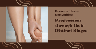 Pressure Ulcers Demystified: Progression through their Distinct Stages