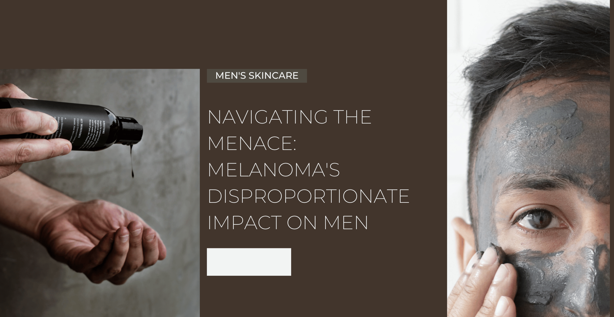 Navigating the Menace: Melanoma's Disproportionate Impact on Men