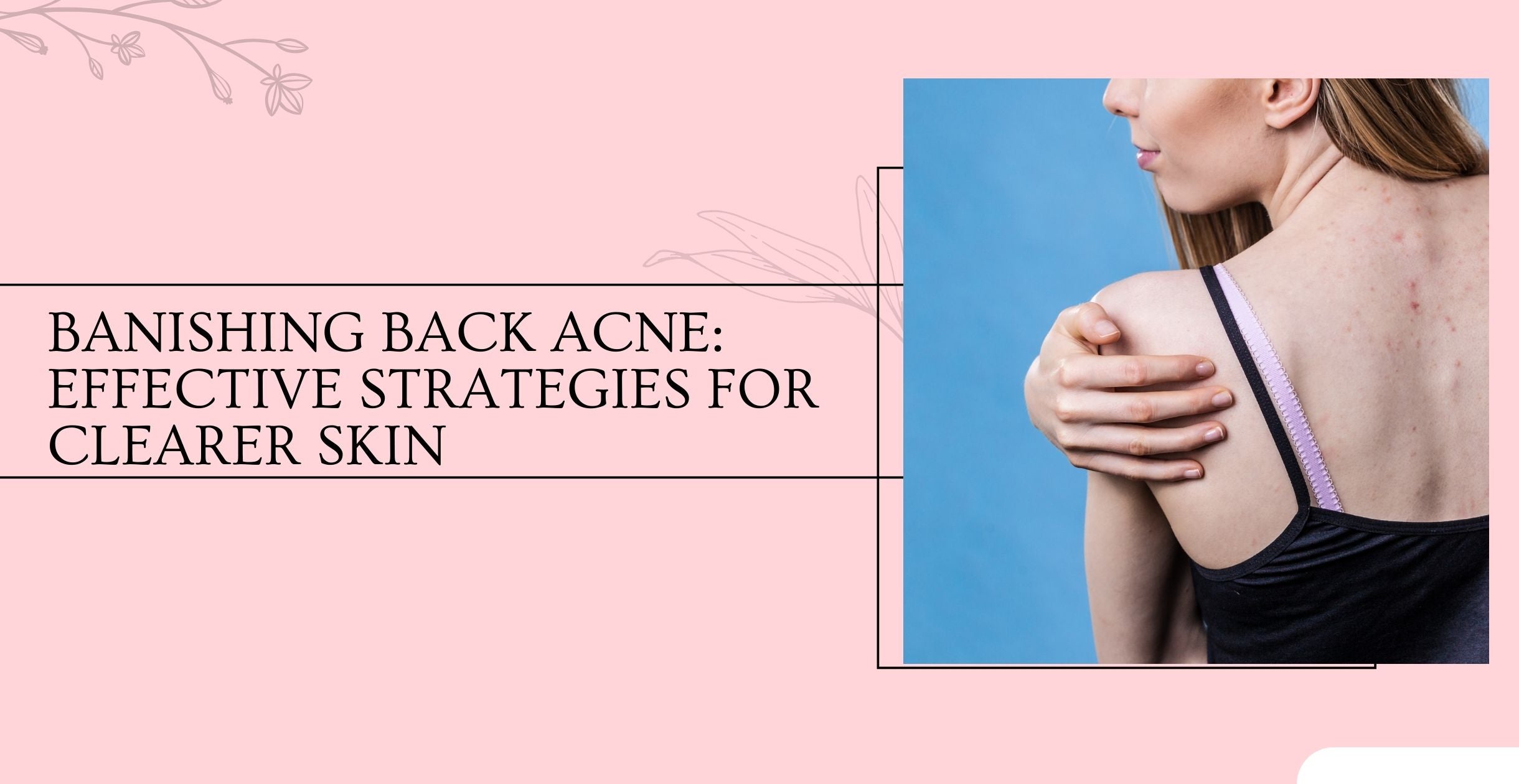 Banishing Back Acne: Effective Strategies for Clearer Skin