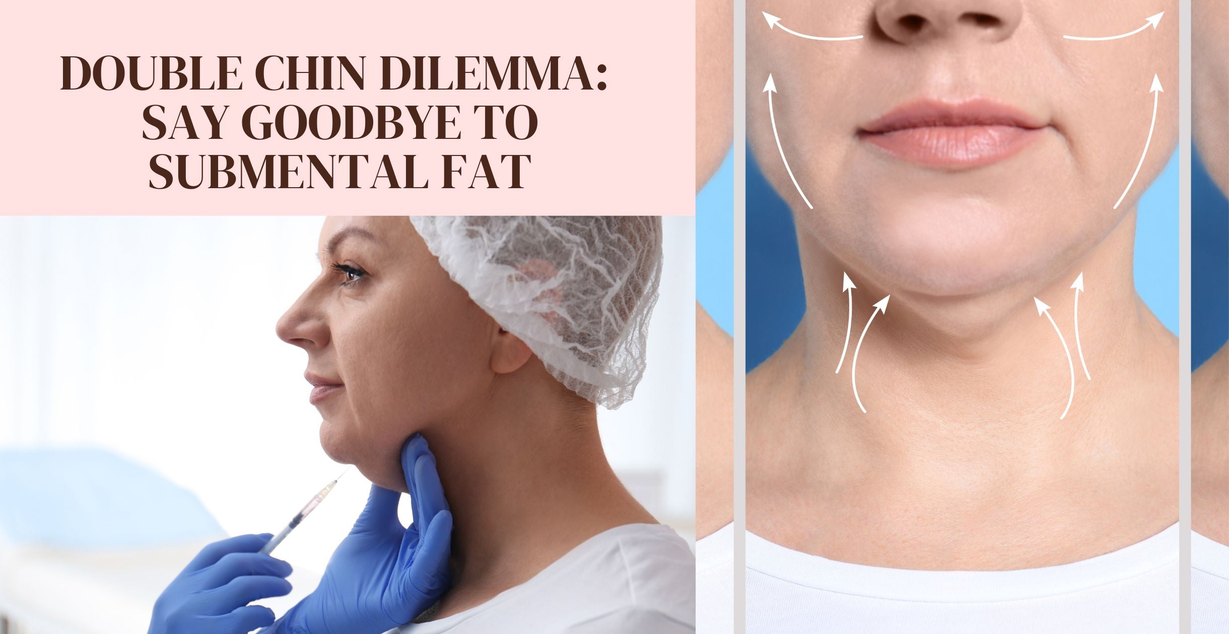 Double Chin Dilemma: Say Goodbye to Submental Fat