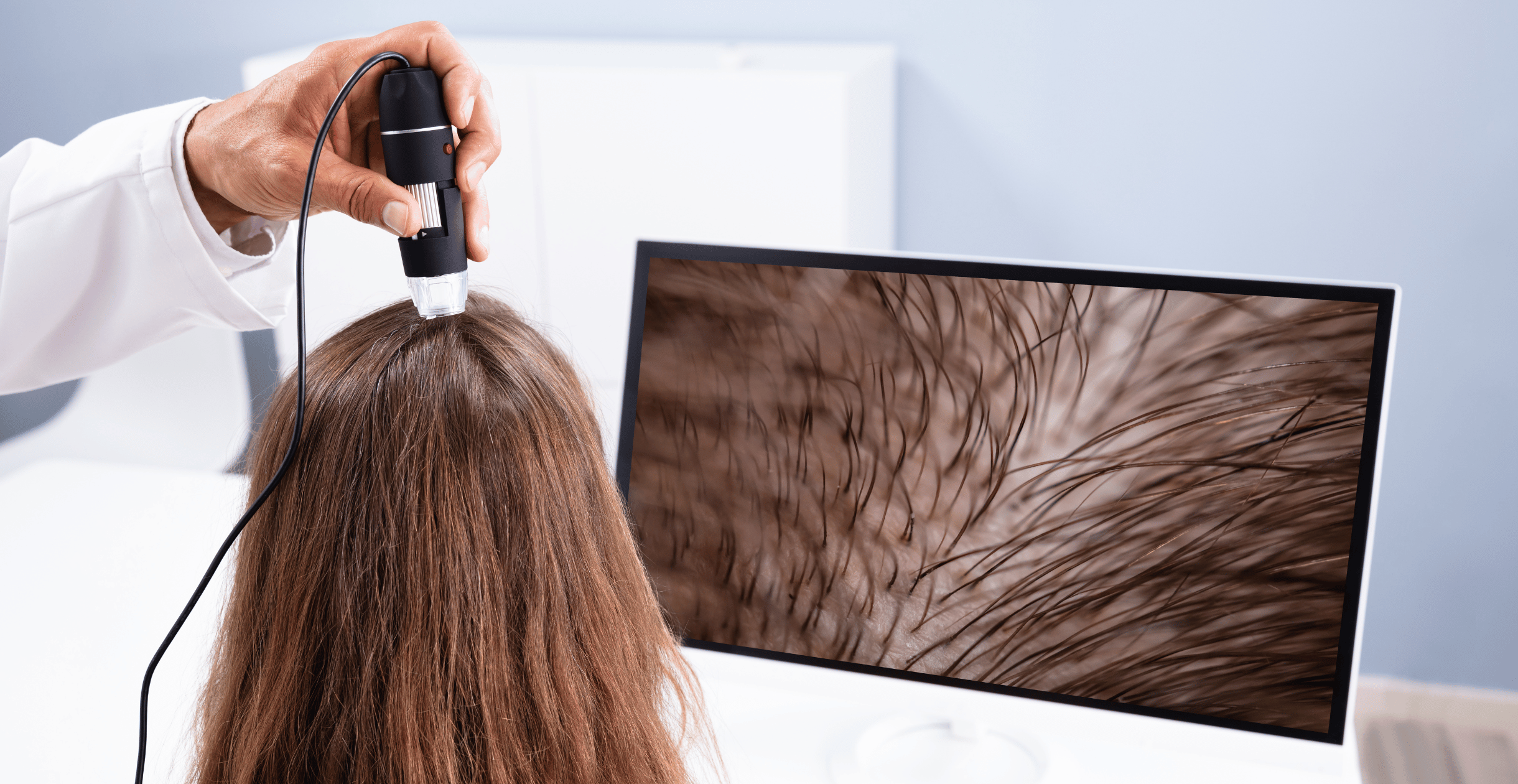 A women was taking scalp treatment from a dermatologist.