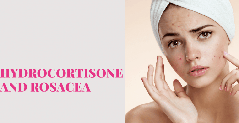 Hydrocortisone and Rosacea Clinikally