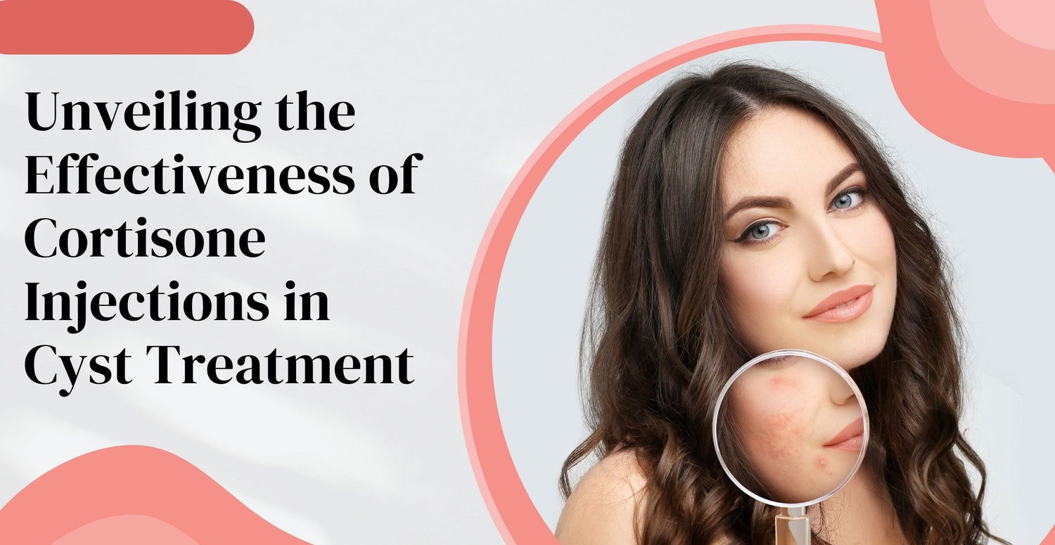 Unveiling the Effectiveness of Cortisone Injections in Cyst Treatment