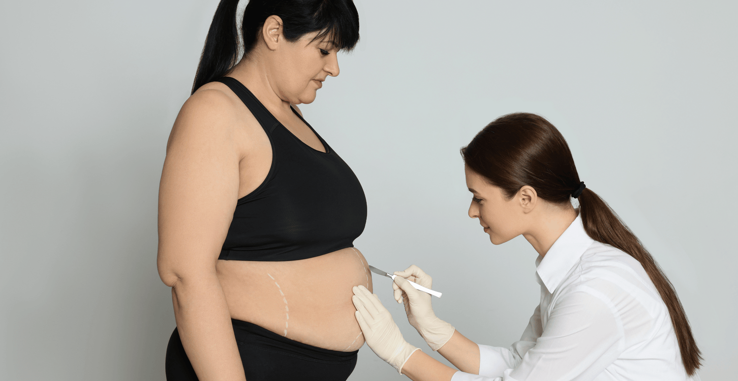 Unlocking Your Path to Success: How to Select the Ideal Non-Surgical Weight Loss Option for Your Needs