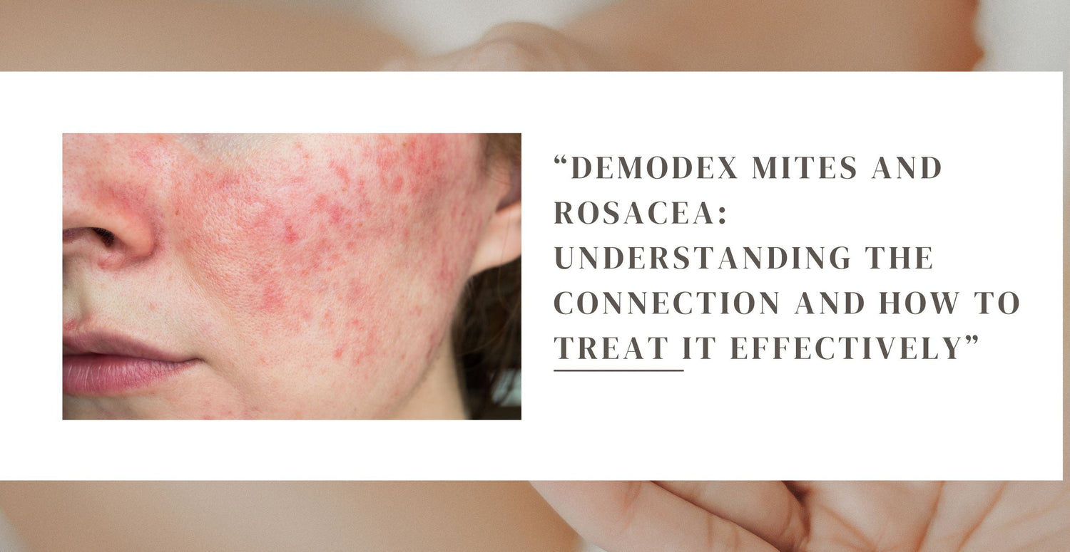 Demodex Mites and Rosacea: Understanding the Connection and How to Treat It Effectively