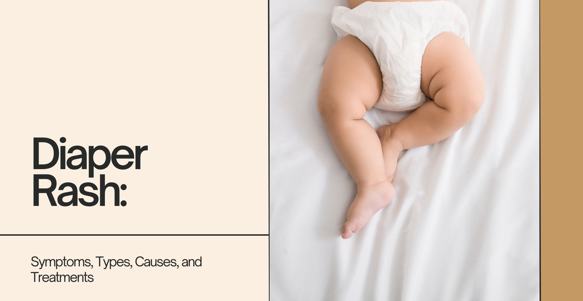 Diaper Rash: Symptoms, Types, Causes, and Treatments