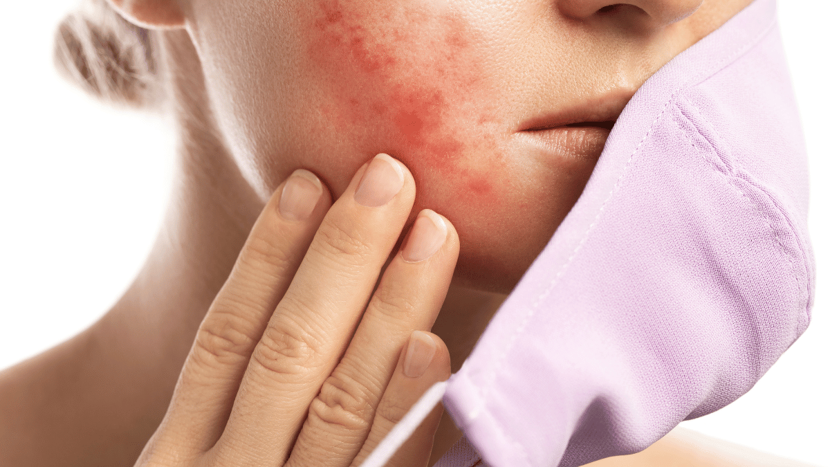 Decoding Acne Purge vs Breakout: Dermatologists Share Their Insights