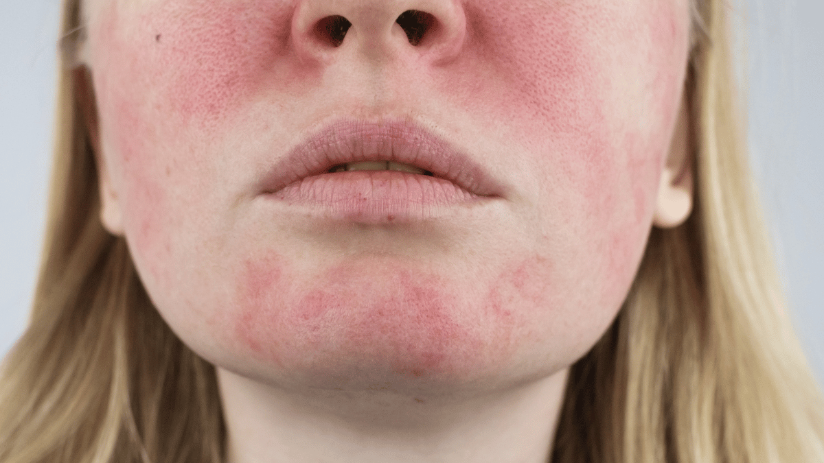 Dermatologist appointment 