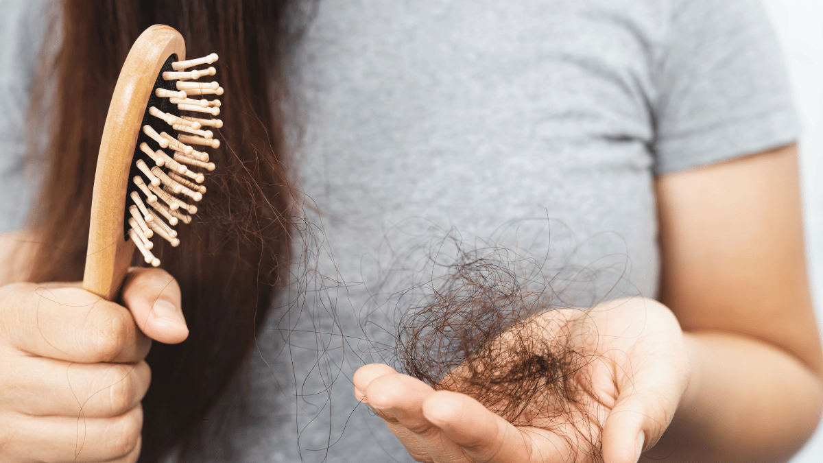 postpartum hair loss