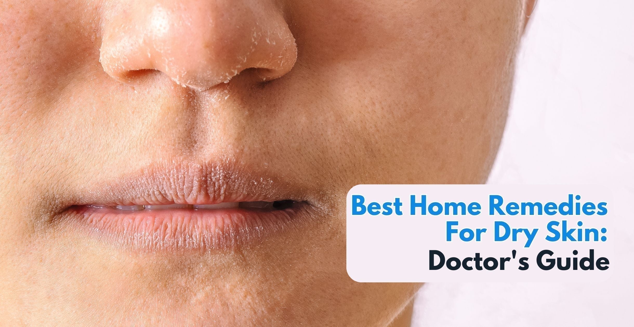 Best Home Remedies For Dry Skin: Doctor's Guide
