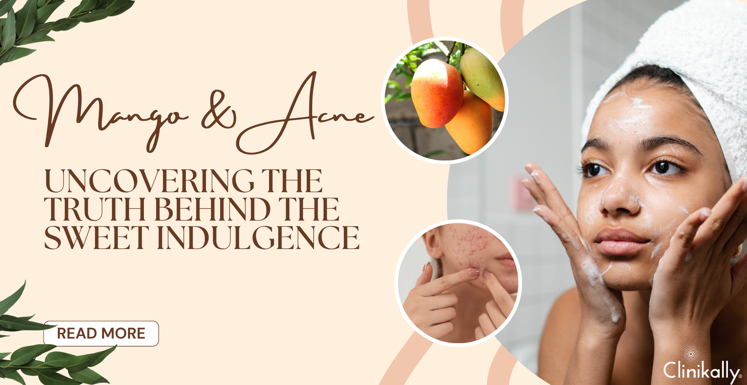 Mango and Acne: Uncovering the Truth Behind the Sweet Indulgence ...