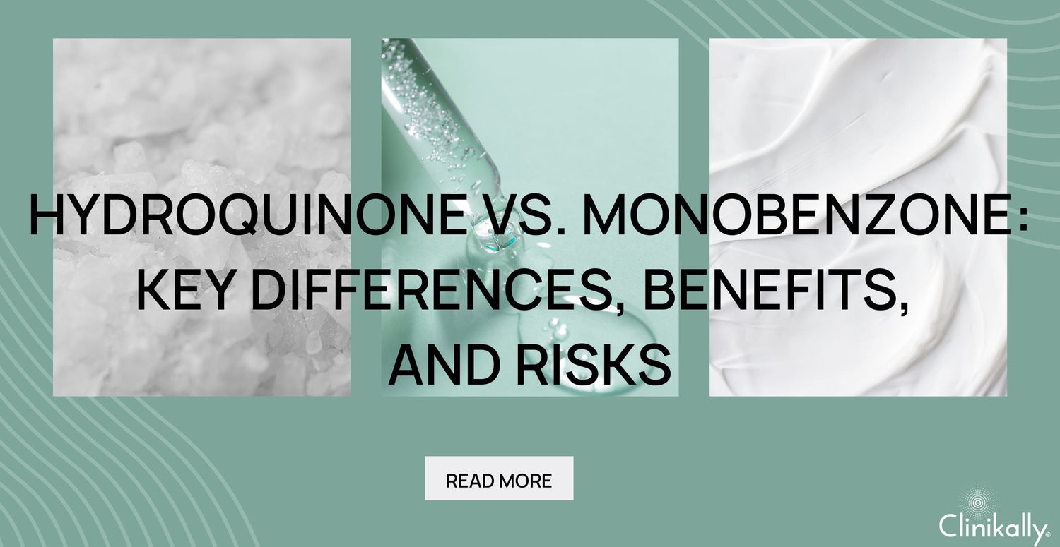 Hydroquinone vs. Monobenzone: Key Differences, Benefits, and Risks