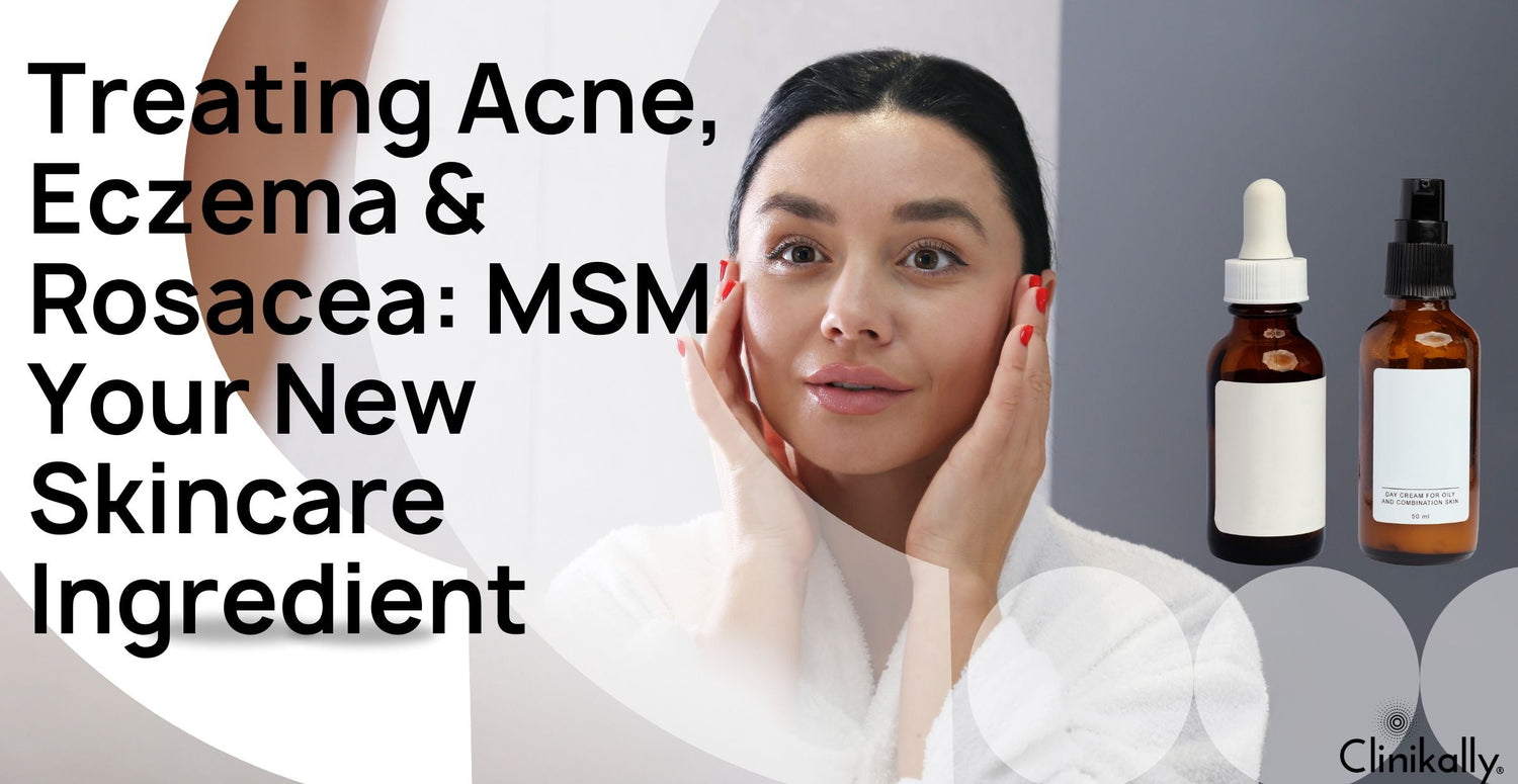 Treating Acne, Eczema & Rosacea: MSM Your New Skincare Ingredient