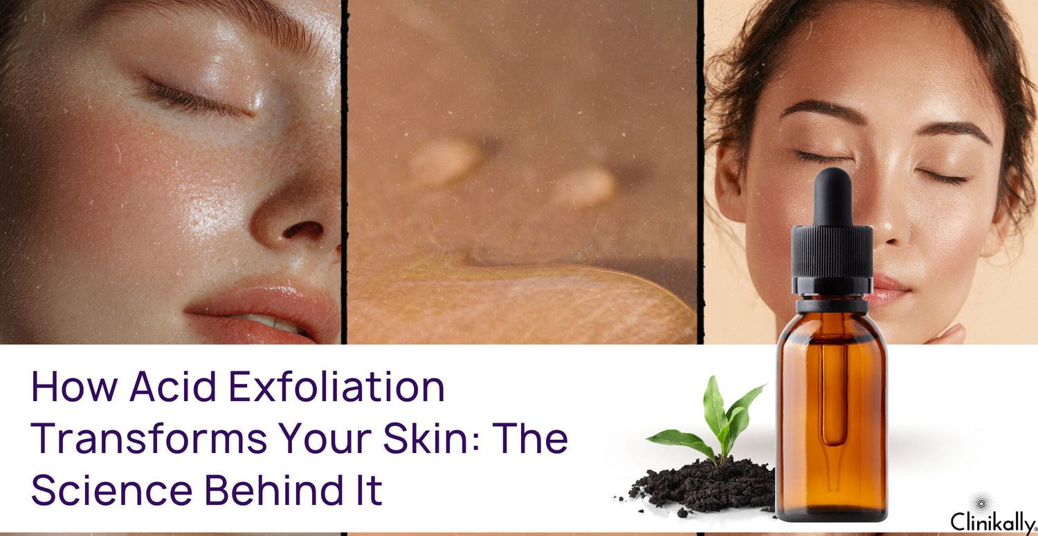 How Acid Exfoliation Transforms Your Skin: The Science Behind It