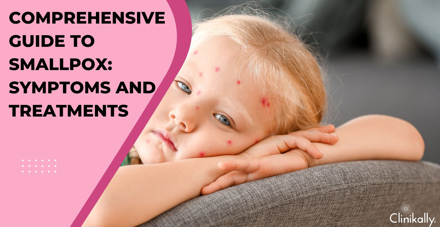 Smallpox: Symptoms, Causes, and Eradication History