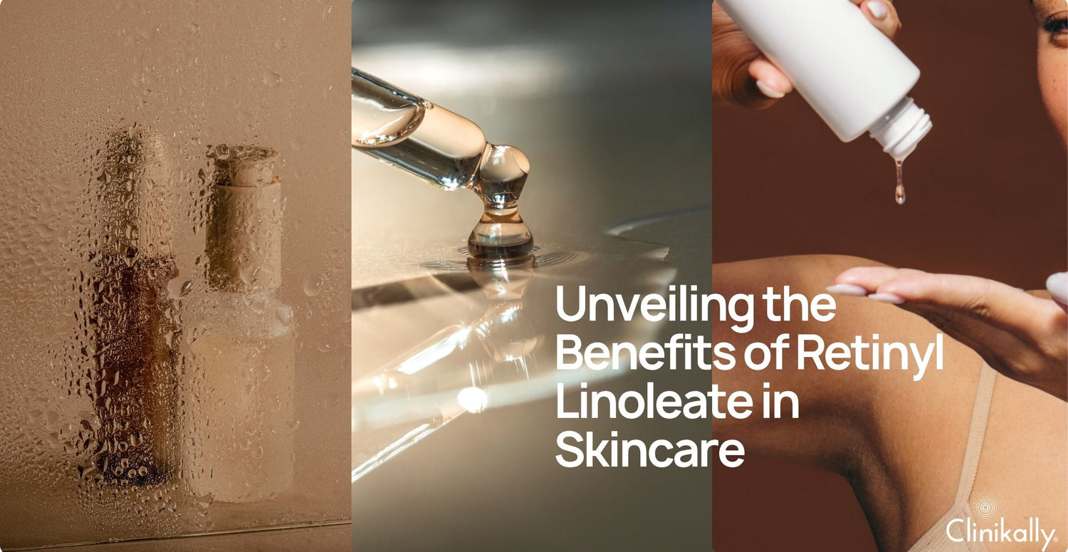 Unveiling the Benefits of Retinyl Linoleate in Skincare