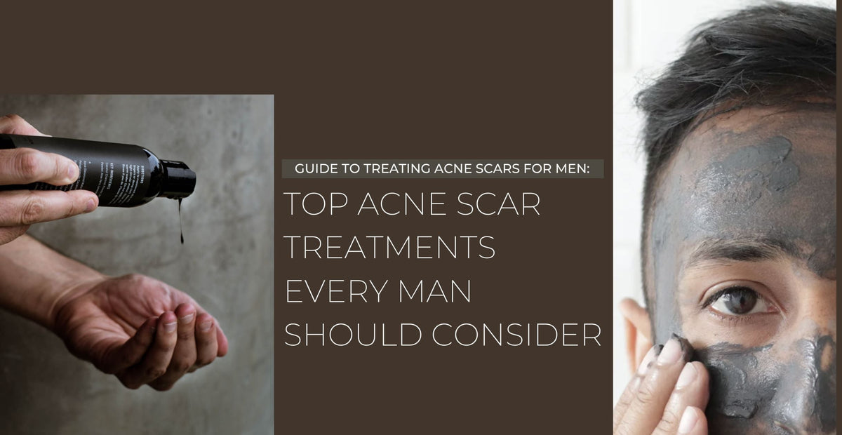 Photo inspiration: Visual Reference: Top Acne Scar Treatments For Men Clear Skin Guide