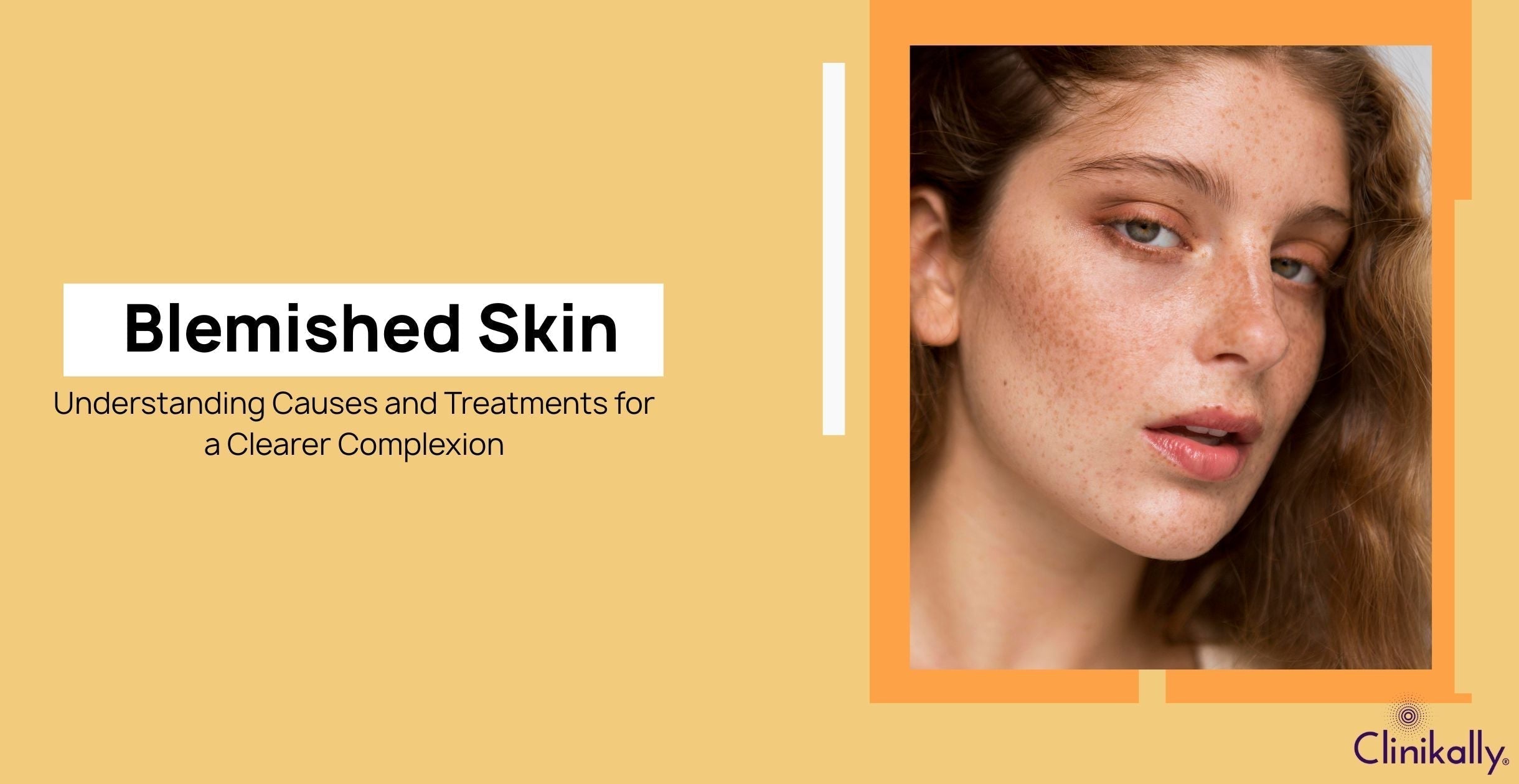Blemished Skin: Understanding Causes and Treatments for a Clearer Complexion