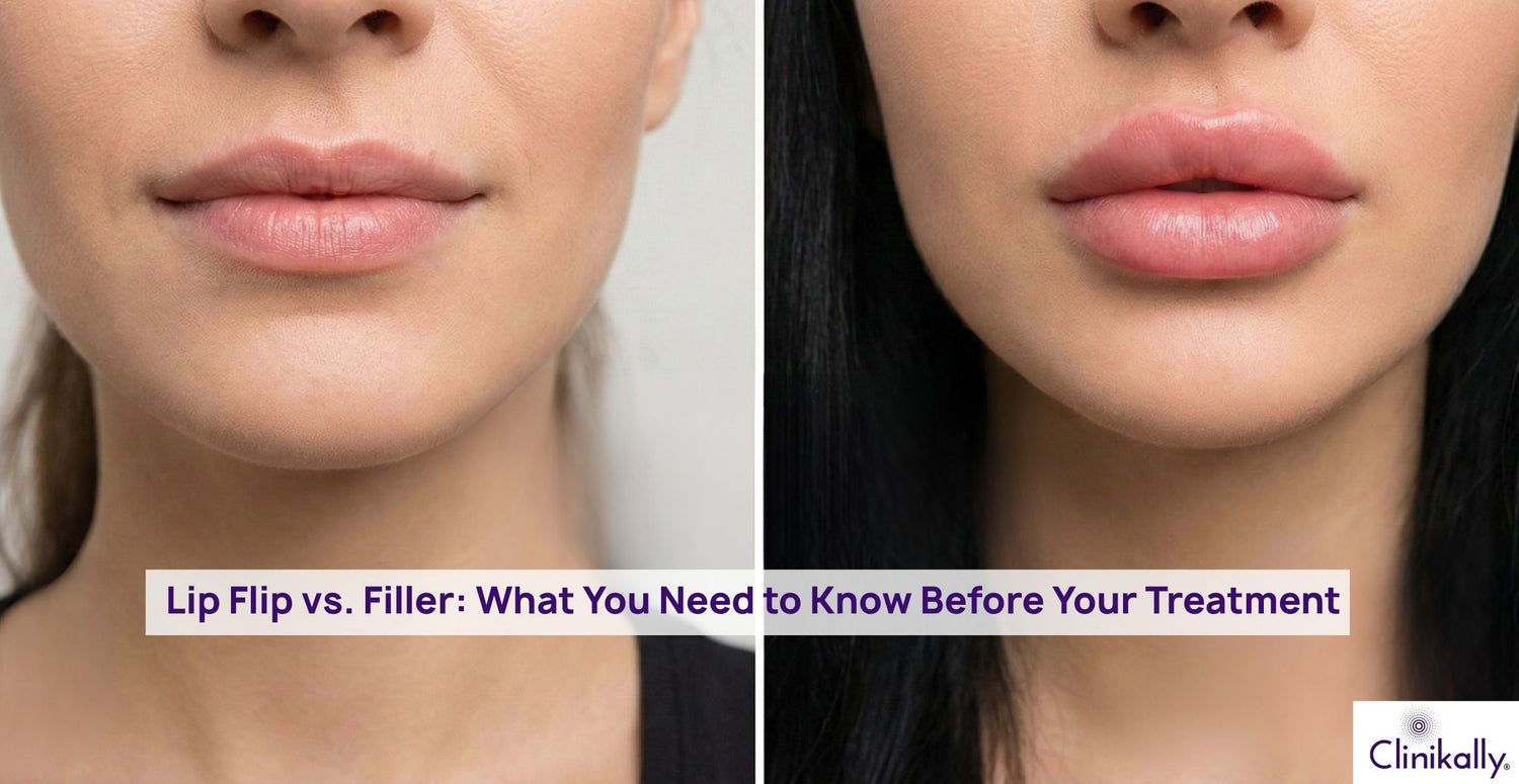 Lip Flip vs. Filler: What You Need to Know Before Your Treatment