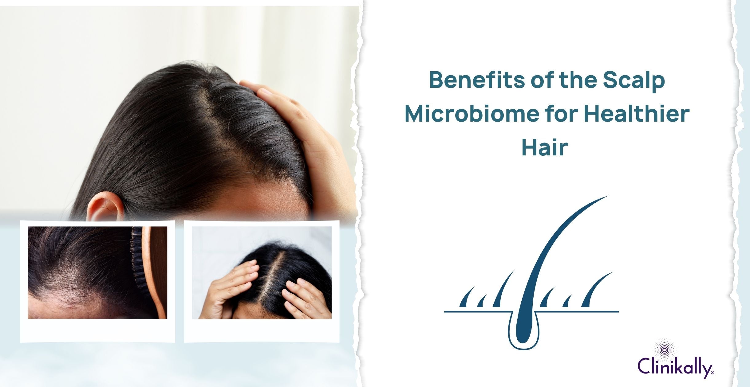Benefits of the Scalp Microbiome for Healthier Hair