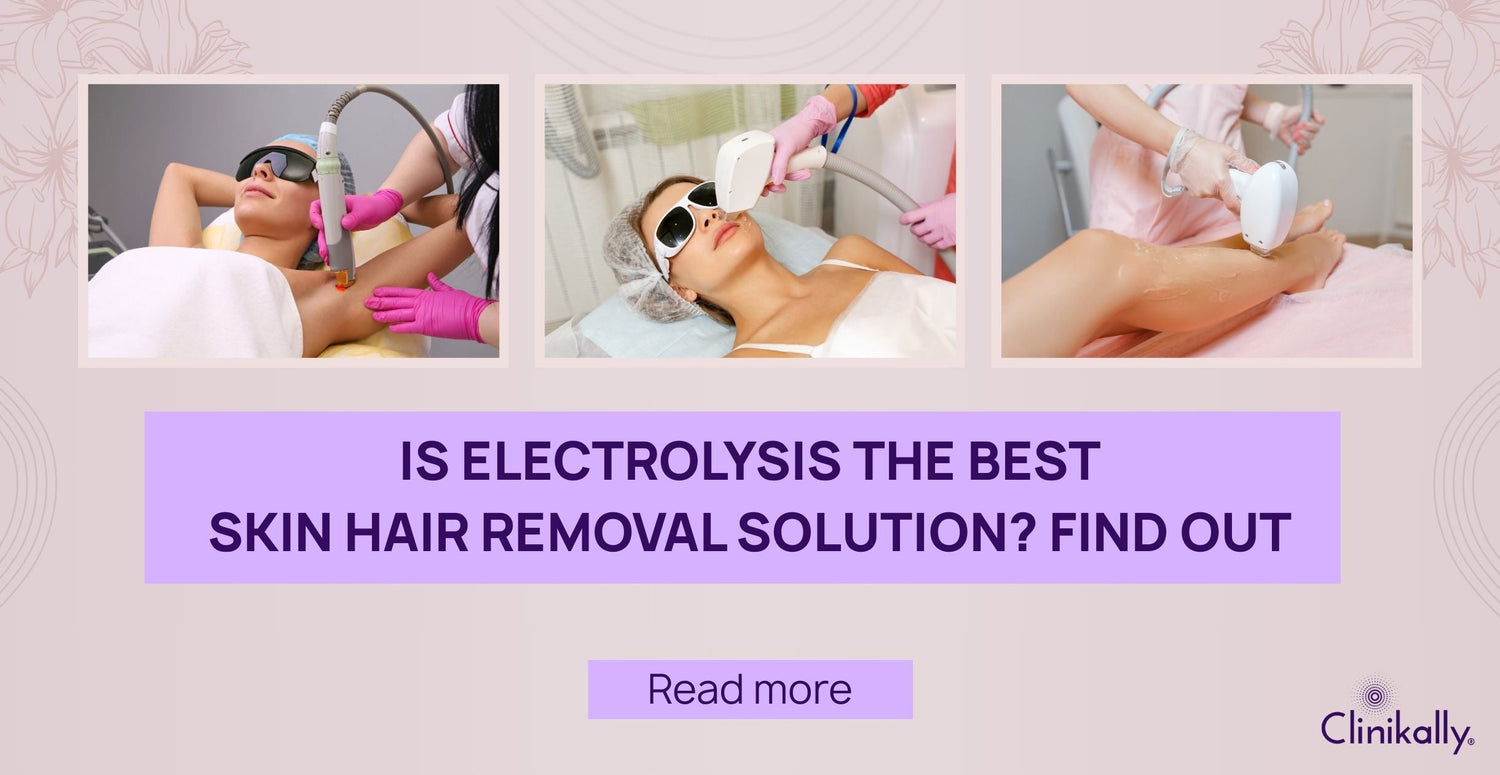 Is Electrolysis the Best Skin Hair Removal Solution? Find Out