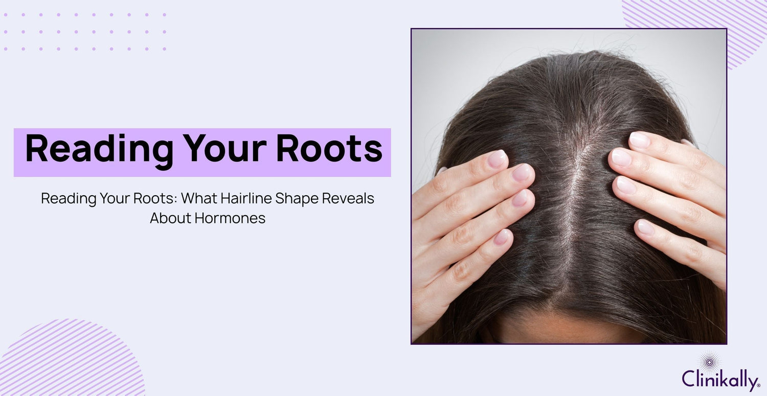 Reading Your Roots: What Hairline Shape Reveals About Hormones
