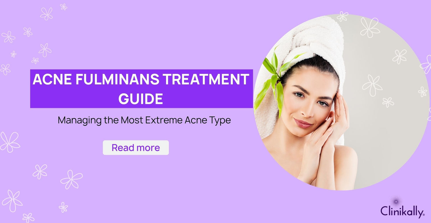 Acne Fulminans Treatment Guide: Managing the Most Extreme Acne Type