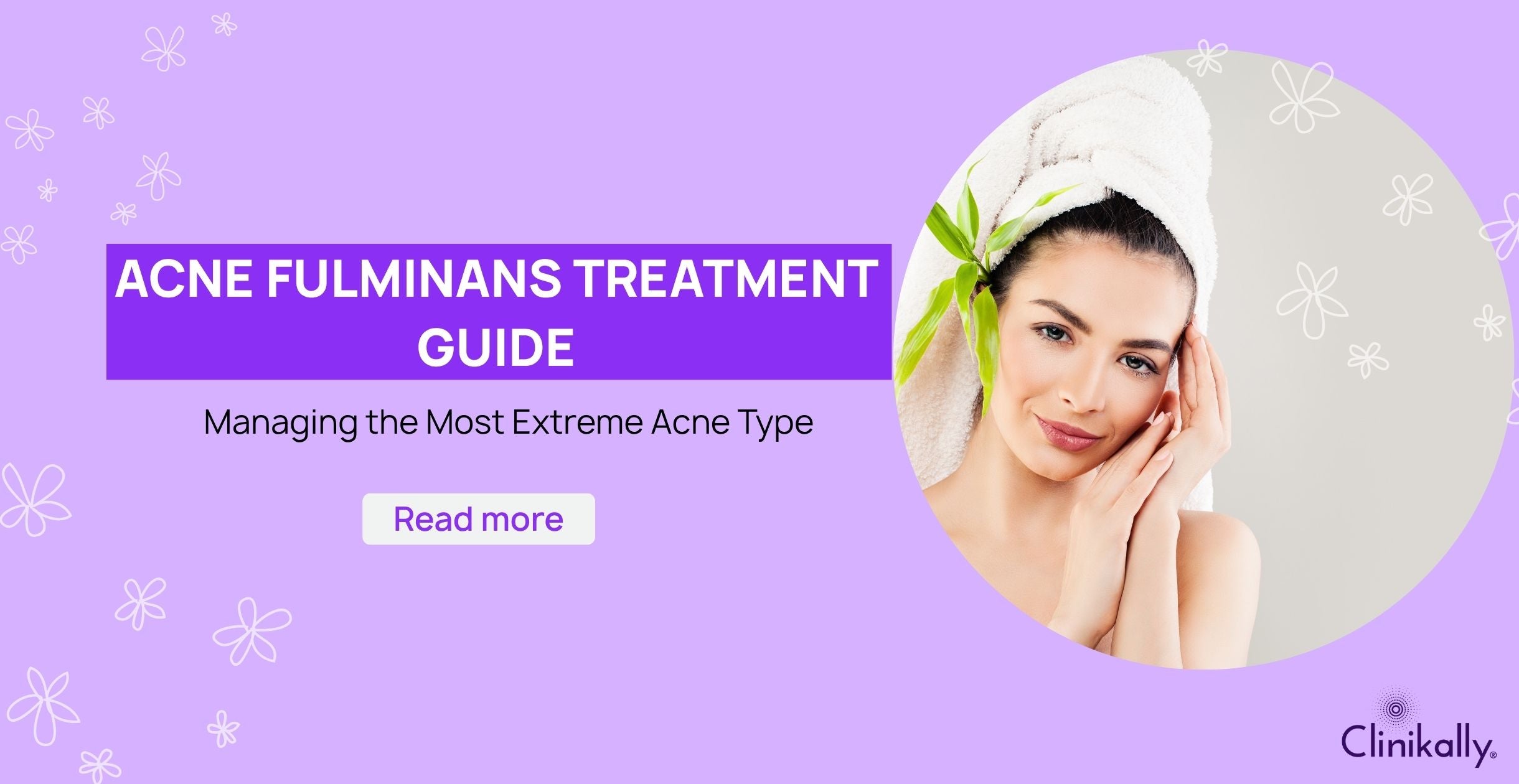 Acne Fulminans Treatment Guide: Managing the Most Extreme Acne Type