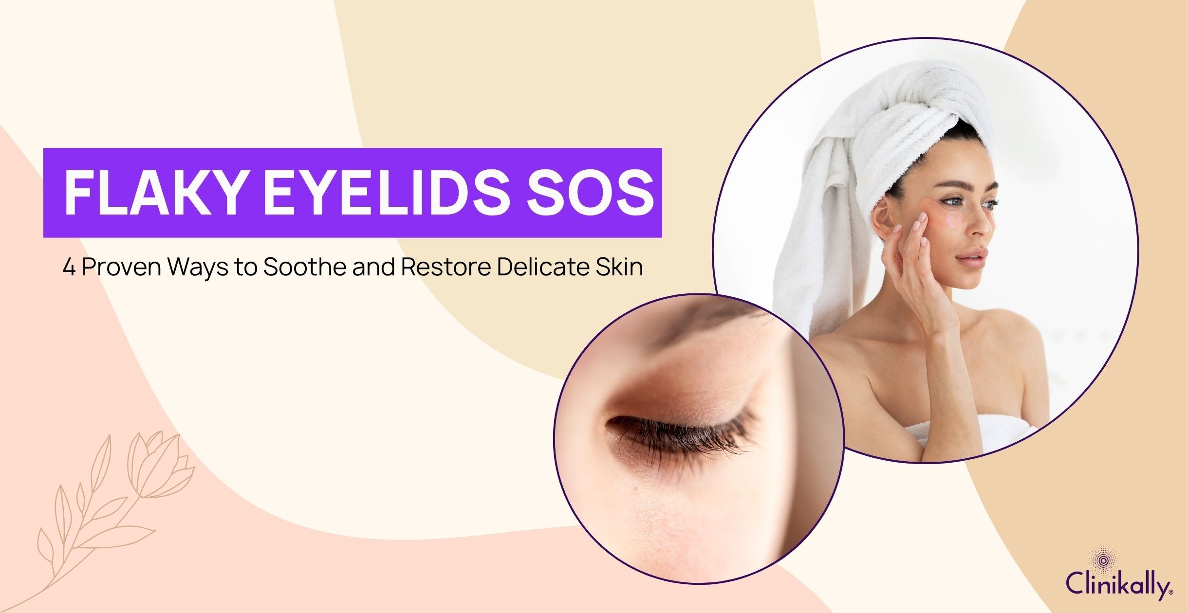 Flaky Eyelids SOS: 4 Proven Ways to Soothe and Restore Delicate Skin