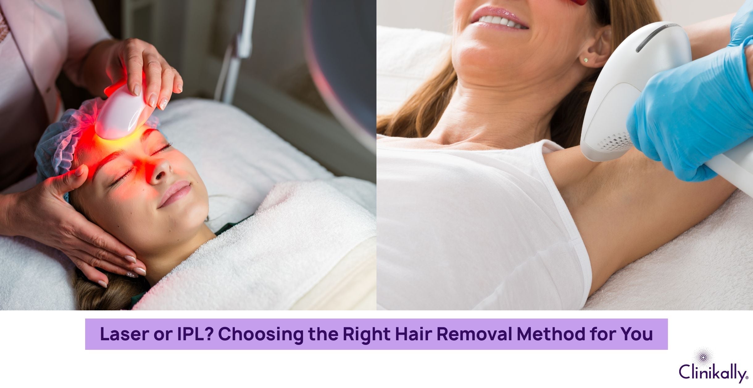 Laser or IPL? Choosing the Right Hair Removal Method for You
