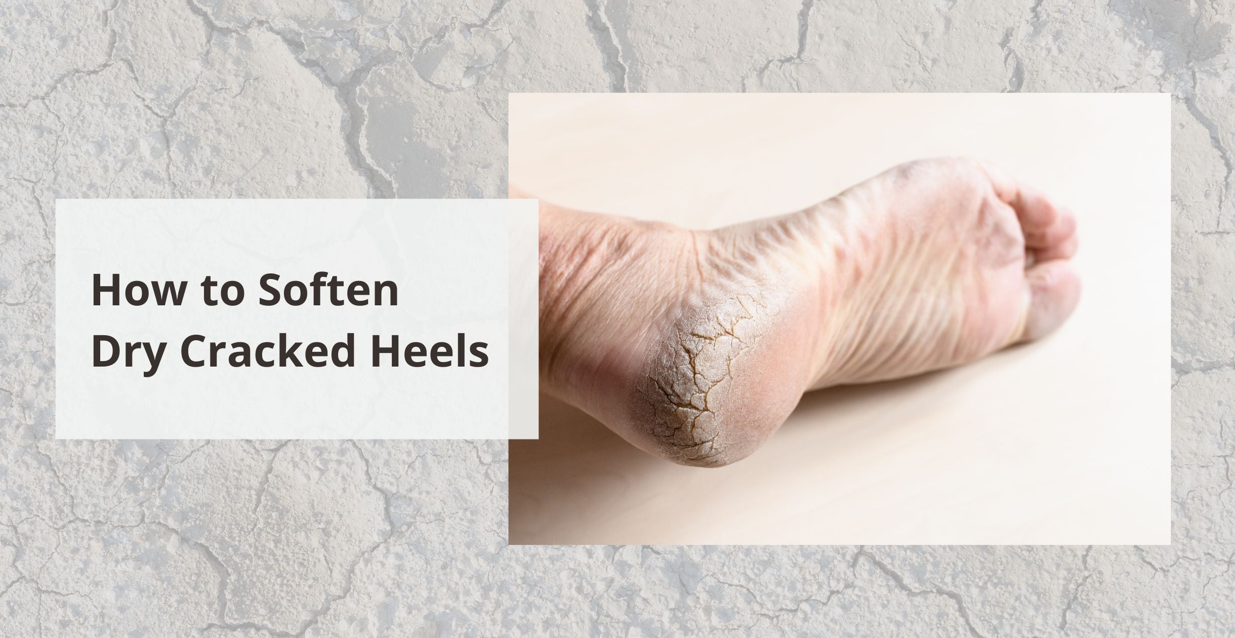 How to Soften Dry Cracked Heels