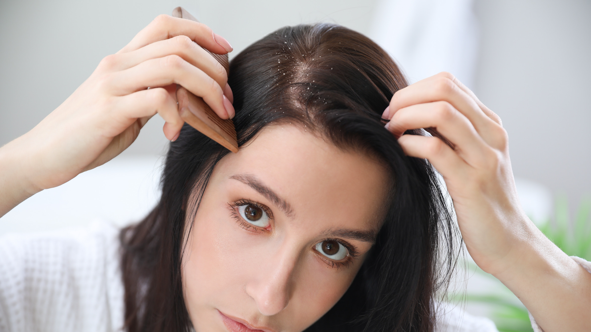 itchy scalp and dandruff
