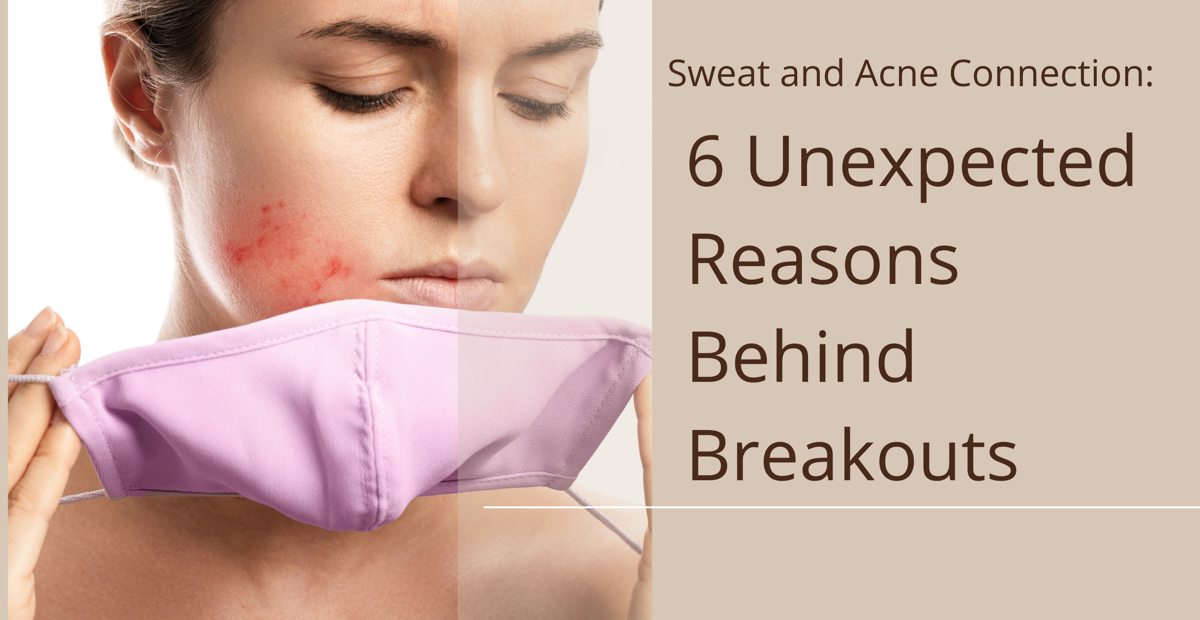Sweat and Acne Connection: 6 Unexpected Reasons Behind Breakouts