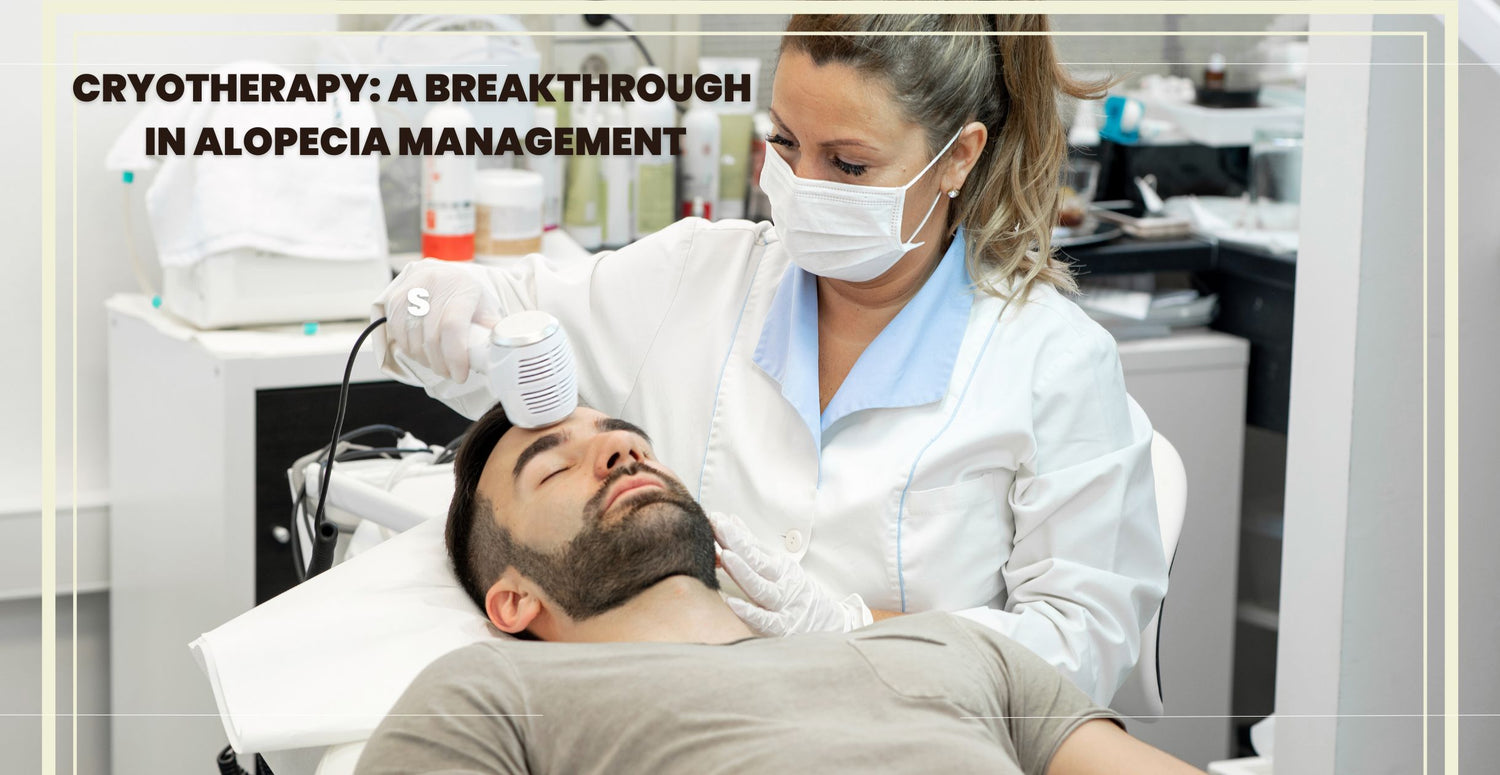 Cryotherapy: A Breakthrough in Alopecia Management