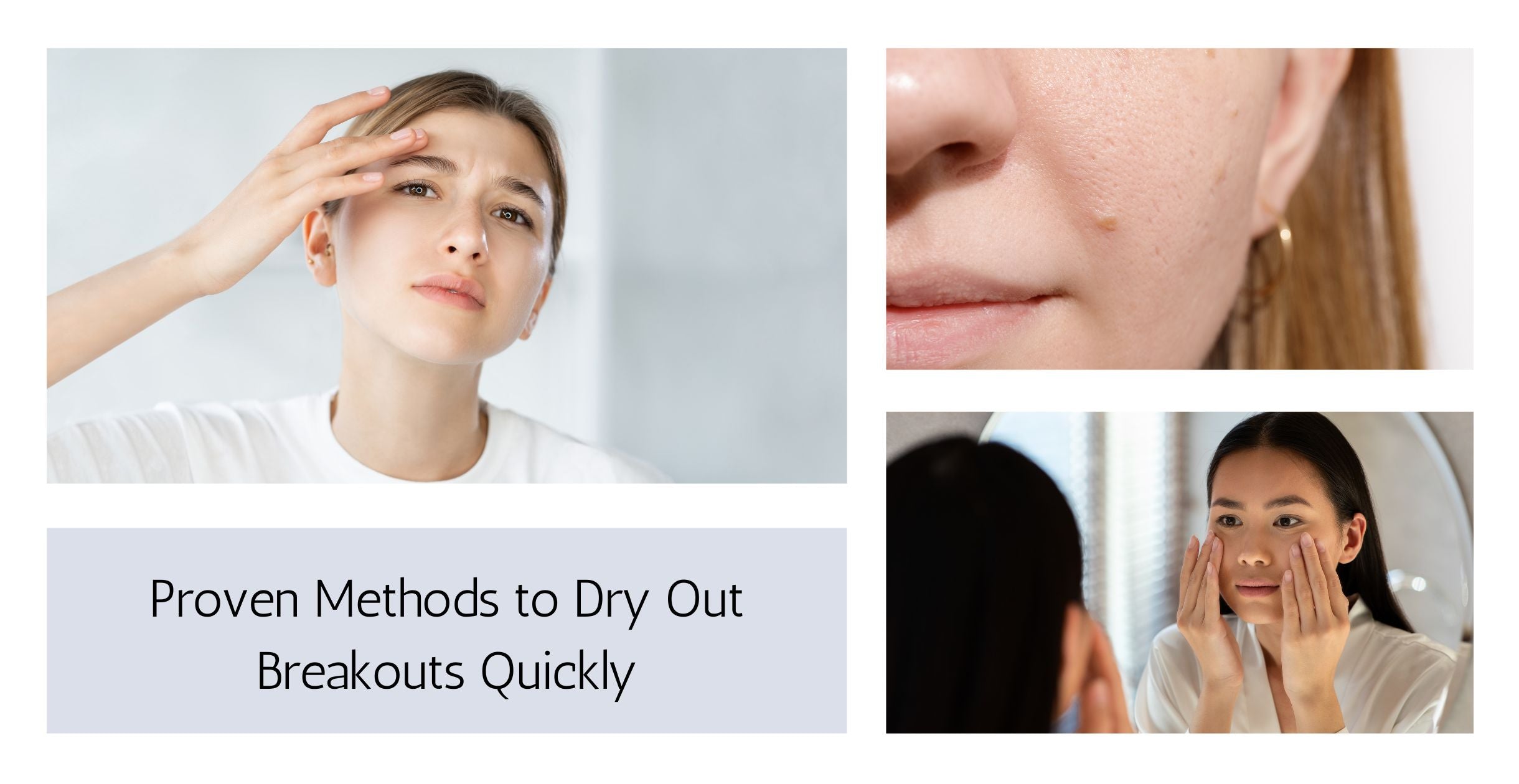 Proven Methods to Dry Out Breakouts Quickly