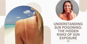 Understanding Sun Poisoning: The Hidden Risks of Sun Exposure