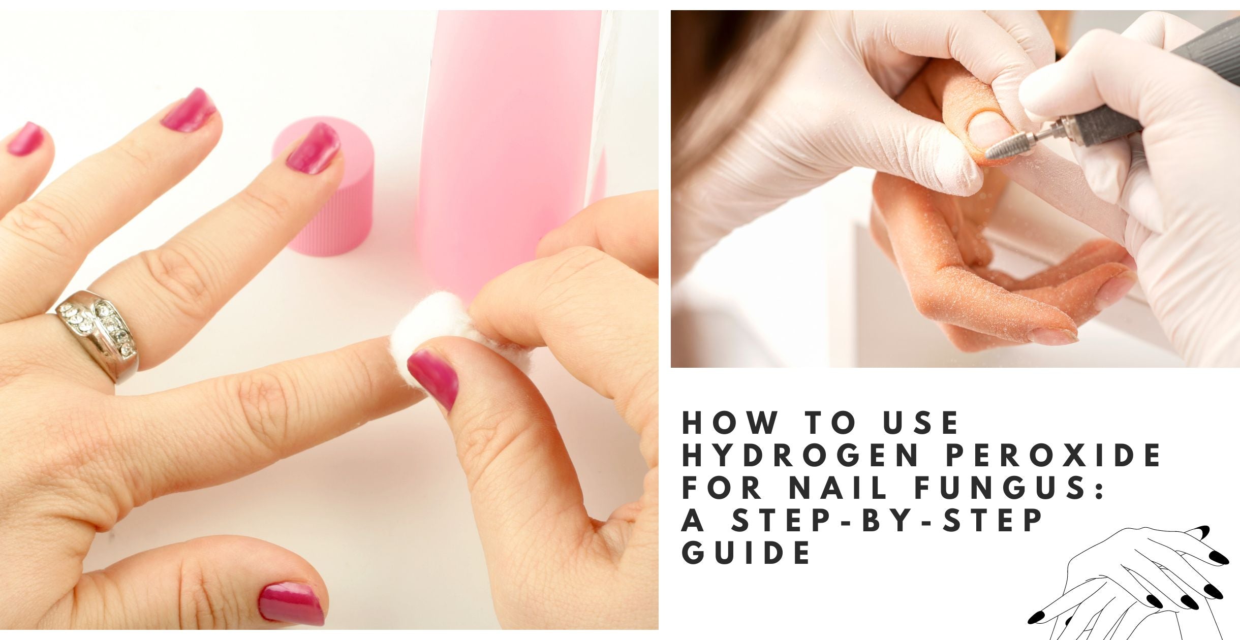 How To Use Hydrogen Peroxide For Nail Fungus: A Step-By-Step Guide