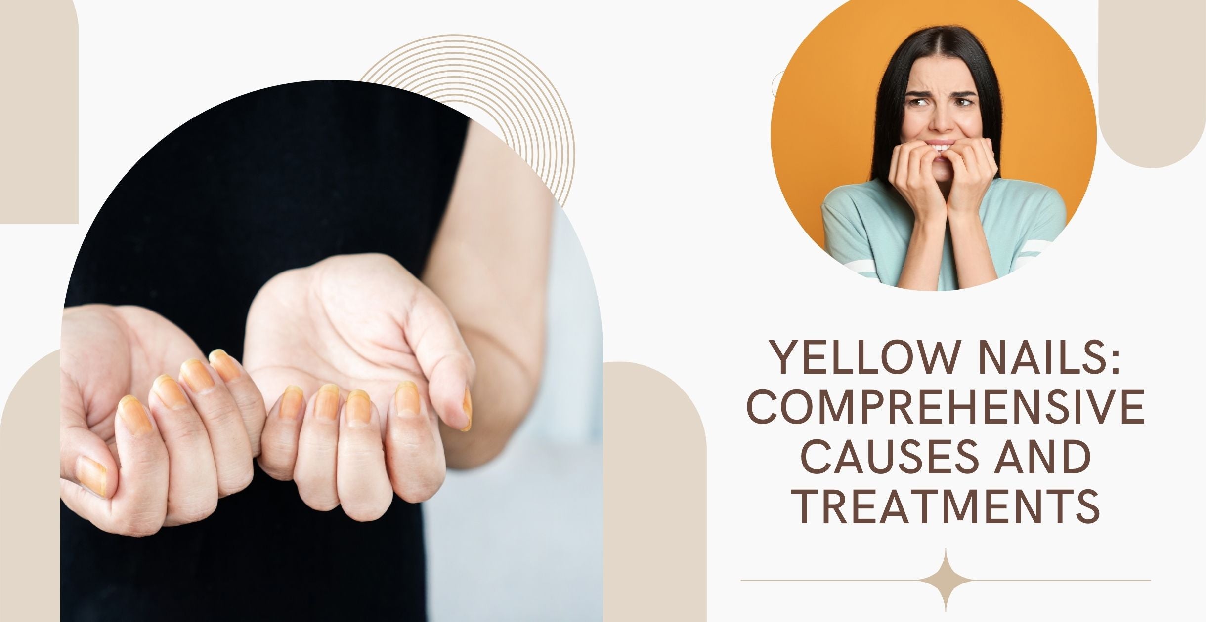 Yellow Nails: Comprehensive Causes and Treatments