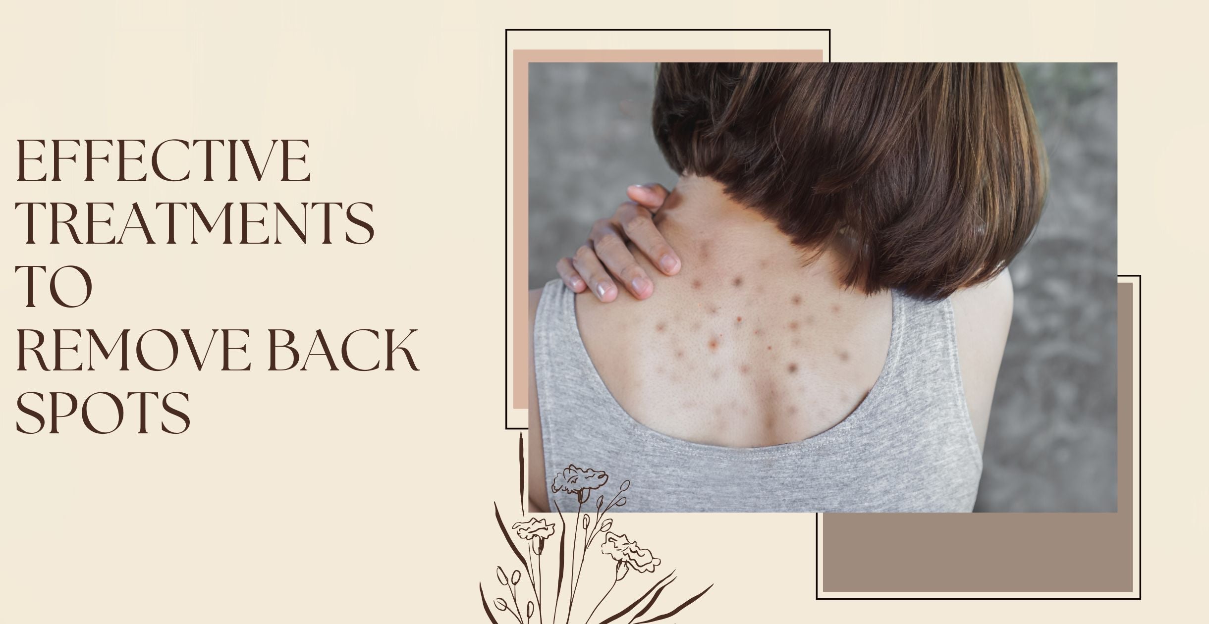 Effective Treatments to Remove Back Spots
