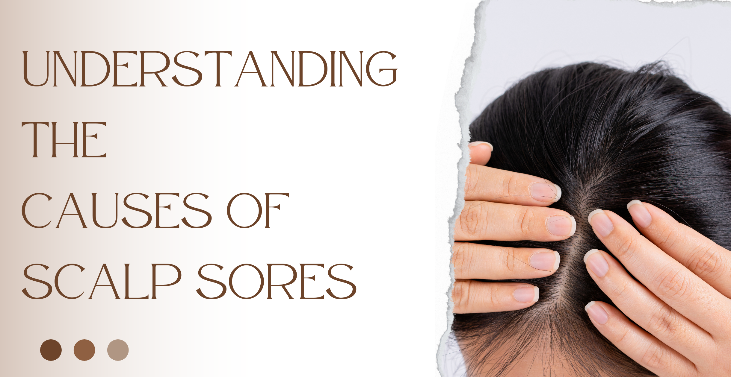 Addressing Scalp Sores: Causes, Treatments, and Prevention Strategies