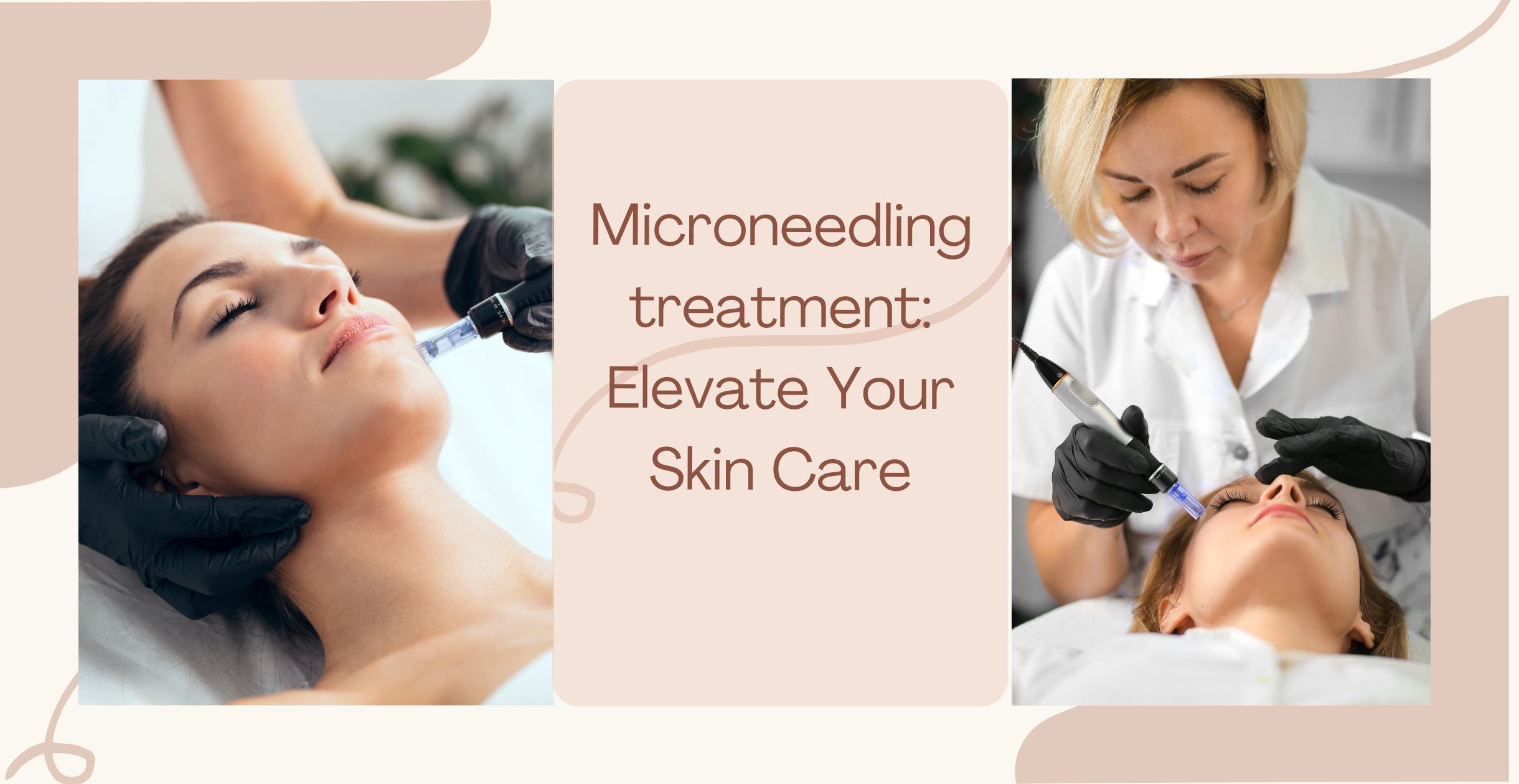 Microneedling treatment: Elevate Your Skin Care